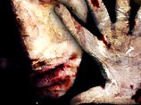 В Камбодже родители покусали свою 12-летнюю дочь, чтобы выпить ее крови В Камбодже родители покусали свою 12-летнюю дочь, чтобы выпить ее крови