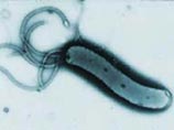 Бактерия Helicobacter pylori, вызывающая все эти болезни, довольно слабый патоген, и может долгое время существовать в организме, не проявляя себя Бактерия Helicobacter pylori, вызывающая все эти болезни, довольно слабый патоген, и может долгое время существовать в организме, не проявляя себя