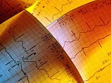 Исследователи считают, что половое бессилие должно быть добавлено к факторам риска болезней сердца наряду с высоким уровнем холестерина, избыточного веса, диабета и курения Исследователи считают, что половое бессилие должно быть добавлено к факторам риска болезней сердца наряду с высоким уровнем холестерина, избыточного веса, диабета и курения