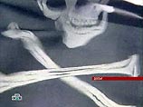 У побережья Сомали экипаж круизного судна отбил атаку пиратов У побережья Сомали экипаж круизного судна отбил атаку пиратов