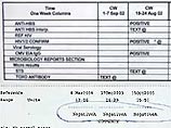 Активисты говорят, что если это правда, то этот феномен может иметь потенциальные благоприятные последствия для миллионов ВИЧ-инфицированных. В одной только Великобритании таких людей – 53 тысячи Активисты говорят, что если это правда, то этот феномен может иметь потенциальные благоприятные последствия для миллионов ВИЧ-инфицированных. В одной только Великобритании таких людей – 53 тысячи
