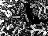 Заболевание вызывает новый, более агрессивный штамм бактерии под названием Clostridium difficile. В последние годы по всему миру были зафиксированы необычно сильные вспышки этой инфекции