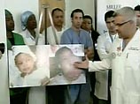 Представитель детской больницы Хольц в Майами (штат Флорида), Роберт Алонсо, сообщил утром в четверг, что врачи закончили оперировать Марли Кессус в 23:40 по местному времени в среду