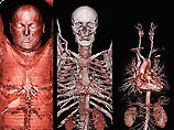 Изобретен самый точный в мире аппарат для медицинской томографии Изобретен самый точный в мире аппарат для медицинской томографии