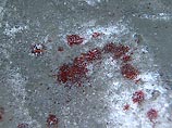 В больницах остаются пять пострадавших прихожан московской синагоги В больницах остаются пять пострадавших прихожан московской синагоги