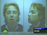 Женщина с пересаженным лицом дала первую пресс-конференцию после операции (ФОТО) Женщина с пересаженным лицом дала первую пресс-конференцию после операции (ФОТО)
