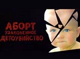Женщины России ежегодно делают 1 миллион 700 тысяч абортов