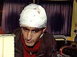 Прокуратура направила в суд дело об избиении сотрудника НТВ Мирзоева Прокуратура направила в суд дело об избиении сотрудника НТВ Мирзоева