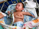 В детской клинике Шанхая врачи столкнулись с необычным случаем - у двухмесячного мальчика три полностью сформировавшихся руки. Хотя ни одна из двух левых рук младенца не функциональна, обе конечности полностью сформировались