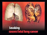 Возможно, в скором времени, курильщикам придется покупать пачки сигарет, на которых вместо надписи про вред курения, будут красоваться изъеденные раком легкие, язвы и бирки на трупах