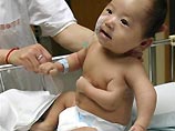 Китайские врачи удалили младенцу третью руку