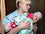 В Москве проведена успешная операция по разделению 11-месячных сиамских близнецов

