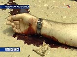 Минзрав Чечни: экспертиза по опознанию убитого "президента Ичкерии" скоро завершится