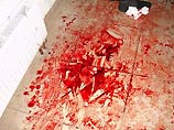 11 января этого года Александр Копцев с охотничьим ножом ворвался в синагогу на Большой Бронной улице в Москве и, выкрикивая антисемитские лозунги, напал на прихожан 11 января этого года Александр Копцев с охотничьим ножом ворвался в синагогу на Большой Бронной улице в Москве и, выкрикивая антисемитские лозунги, напал на прихожан
