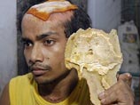 В Калькутте сотни людей собираются поглазеть на прославившегося электрика Самбу Роя. 25-летний индус с удовольствием демонстрирует всем желающим часть своего собственного черепа, которую он держит в руке