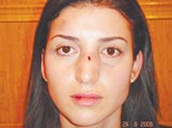 На прошлой неделе певица попала в одну из московских клиник со сломанным носом, гематомами и синяками на теле. По одной из версий, ее избил муж