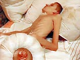 19-летний призывник из Казани Радик Хабиров, доставленный домой в состоянии комы и с весом в 28 кг из воинской части, где он проходил службу, помещен в реанимацию Казанского госпиталя ветеранов войны 19-летний призывник из Казани Радик Хабиров, доставленный домой в состоянии комы и с весом в 28 кг из воинской части, где он проходил службу, помещен в реанимацию Казанского госпиталя ветеранов войны