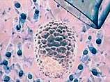 Сенат США разрешил проводить исследования стволовых клеток человека