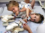 В Солт-Лейк-Сити врачи готовятся разделить сиамских близнецов, имеющих одну почку на двоих