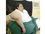 Самый толстый человек в мире будет прооперирован в Италии (ФОТО)