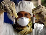 Ученые США: вирус "птичьего гриппа" опасен лишь для некоторых