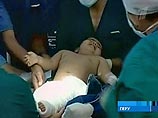 "Девочке-русалке" провели новую операцию, полностью разделив ноги "Девочке-русалке" провели новую операцию, полностью разделив ноги