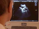 Ученые США: у высоких женщин больше шансов родить близнецов Ученые США: у высоких женщин больше шансов родить близнецов