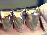 Президент Таджикистана запретил своим гражданам иметь золотые зубы