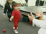 Двухлетняя перуанка Милагрос Серрон, известная как "маленькая русалка", которая родилась со сросшимися нижними конечностями, после серии операций начала делать первые шажки