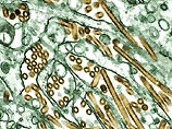 В России с наступлением осени прекратился падеж птиц от вируса H5N1 В России с наступлением осени прекратился падеж птиц от вируса H5N1