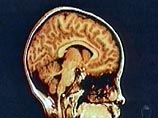 Американский ученый изобрел оперативную память для человеческого мозга