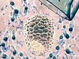 Использование коровьих яйцеклеток позволит исключить операцию, через которую приходится проходить женщине-донору. При этом, по мнению британских ученых, эмбрион на 99,9% будет человеческим, поскольку заменяется вся ДНК в ядре клетки