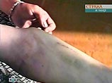 Федеральная служба по наркоконтролю РФ советует родителям проверять своих детей на наркотики Федеральная служба по наркоконтролю РФ советует родителям проверять своих детей на наркотики