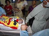 В Китае успешно разделили 28-дневных сиамских близнецов, сросшихся животами