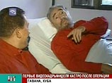 Фидель Кастро сам избрал вид операции на кишечнике, который привел к осложнениям