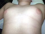 Косметика с эфирными маслами может вызвать рост груди у мальчиков, предупреждают врачи