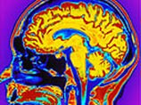 Нейрофизиологи изобрели методику, позволяющую узнавать подсознательные намерения людей