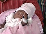В США выжила родившаяся рекордно недоношенной девочка весом 280 граммов