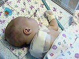 Дело врачей, по вине которых двухмесячной девочке ампутировали руку, передали в суд Дело врачей, по вине которых двухмесячной девочке ампутировали руку, передали в суд