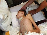 Домой Радик вернулся в коме, потеряв 50 килограммов своего веса Домой Радик вернулся в коме, потеряв 50 килограммов своего веса