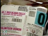 Ученые нашли способ переливать людям кровь любой группы