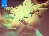 9-месячные девочки Пантаван и Панвад Тиенджаи была разделены еще в конце февраля командой из 61 медика, среди которых было пять кардиохирургов. Операция длилась двенадцать чалов в больнице Siriraj в Банкоке