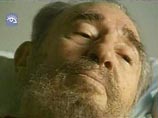 Кубинский лидер Фидель Кастро "почти полностью выздоровел" после операции на кишечнике в прошлом году Кубинский лидер Фидель Кастро "почти полностью выздоровел" после операции на кишечнике в прошлом году