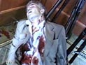 Покусанные англичанки отсудили около 2000 евро у отеля Покусанные англичанки отсудили около 2000 евро у отеля