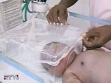 девочка, появившаяся на свет на 10 дней раньше срока, помещена в отделение недоношенных детей, поскольку страдает затруднениями дыхания