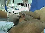 Китайские хирурги в городе Гуанчжоу провели уникальную операцию - они успешно удалили 15-килограммовую доброкачественную опухоль с лица и головы 31-летнего пациента Хуан Чуньцая