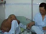 Китайские хирурги прооперировали "человека-слона": с лица и шеи удалена 15-килограммовая опухоль (ВИДЕО)