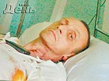Москвичка за измену сожгла половой орган бывшего мужа Москвичка за измену сожгла половой орган бывшего мужа