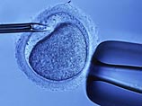 Прорыв в лечении бесплодия: человеческие яйцеклетки будут выращивать в лаборатории