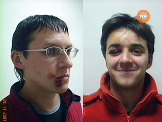 В Москву вернулась съемочная бригада компании РЕН ТВ, члены которой в ночь на субботу были похищены и избиты в Ингушетии